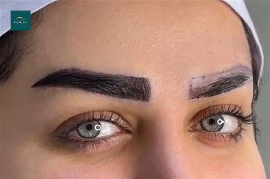 زیباتر شدن از ابروها شروع می‌شود؛ کاشت ابرو بهتر است یا میکروبلیدینگ و تاتو؟