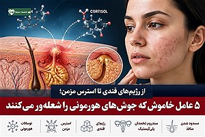 از رژیم‌های قندی تا استرس مزمن؛ ۵ عامل خاموش که جوش‌های هورمونی را شعله‌ور می‌کنند + روش‌های درمان ترکیبی